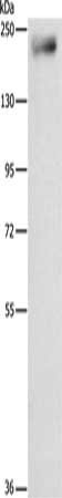 Gel: 8%SDS-PAGE, Lysate: 40 ug, Lane: Mouse lung tissue, Primary antibody: CSB-PA283992(IQGAP3 Antibody) at dilution 1/850, Secondary antibody: Goat anti rabbit IgG at 1/8000 dilution, Exposure time: 1 minute
