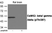 Western blot analysis of extracts from Rat brain using CaMK2- beta/ gamma/ delta (Phospho-Thr287) Antibody.The lane on the right is treated with the antigen-specific peptide.