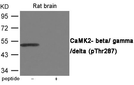 Western blot analysis of extracts from Rat brain using CaMK2- beta/ gamma/ delta (Phospho-Thr287) Antibody.The lane on the right is treated with the antigen-specific peptide.