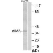 Western blot analysis of extracts from HUVEC cells, using AIM2 antibody.