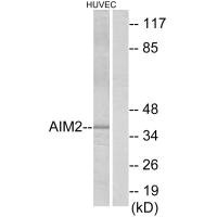 Western blot analysis of extracts from HUVEC cells, using AIM2 antibody.