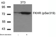 Western blot analysis of extracts from 3T3 cells untreated or treated with serum starvation using FKHR(Phospho-Ser319) Antibody.