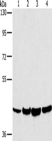 Gel: 8%SDS-PAGE, Lysate: 40 ug, Lane 1-4: Mouse lung tissue, Mouse liver tissue, hela cells, MCF7 cells, Primary antibody: CSB-PA284372(LILRA1 Antibody) at dilution 1/250, Secondary antibody: Goat anti rabbit IgG at 1/8000 dilution, Exposure time:...