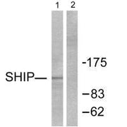 Western blot analysis of extracts from Jurkat cells, treated with PMA (1ng/ml, 15mins), using SHIP antibody.