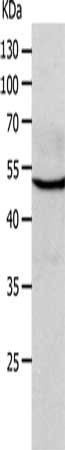 Gel: 10%SDS-PAGE, Lysate: 40 ug, Lane: A549 cells, Primary antibody: CSB-PA284821(CHRNA10 Antibody) at dilution 1/250, Secondary antibody: Goat anti rabbit IgG at 1/8000 dilution, Exposure time: 10 seconds