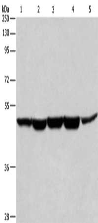 Gel: 8%SDS-PAGE, Lysate: 40 ug, Lane 1-5: Human bladder cancer tissue, A375 cells, K562 cells, Hela cells, HepG2 cells, Primary antibody: CSB-PA284867(HNRNPF Antibody) at dilution 1/350, Secondary antibody: Goat anti rabbit IgG at 1/8000 dilution,...