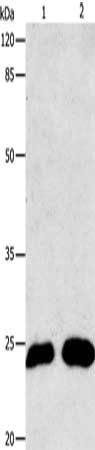 Gel: 10%SDS-PAGE, Lysate: 30 ug, Lane 1-2: 231 cells, A549 cells, Primary antibody: CSB-PA284962(MT-CO2 Antibody) at dilution 1/200, Secondary antibody: Goat anti rabbit IgG at 1/8000 dilution, Exposure time: 10 seconds
