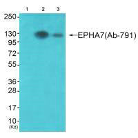 Western blot analysis of extracts from JK cells (Lane 2) and K562 cells (Lane 3), using EPHA7 (Ab-791) antiobdy. The lane on the left is treated with synthesized peptide.
