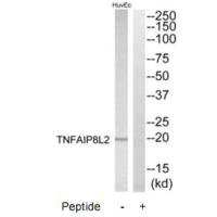 Western blot analysis of extracts from HuvEc cells, using TNFAIP8L2 antibody.