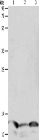 Gel: 12%SDS-PAGE, Lysate: 10 ug, Lane 1-3: Human seminoma tissue, hela cells, A549 cells, Primary antibody: CSB-PA285861(PFN1 Antibody) at dilution 1/1000, Secondary antibody: Goat anti rabbit IgG at 1/8000 dilution, Exposure time: 1 minute