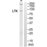 Western blot analysis of extracts from Jurkat cells, using LTK antibody.