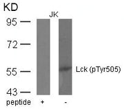 Western blot analysis of extracts from JK cells using Lck(phospho-Tyr505) Antibody and the same antibody preincubated with blocking peptide.