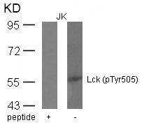 Western blot analysis of extracts from JK cells using Lck(phospho-Tyr505) Antibody and the same antibody preincubated with blocking peptide.