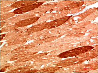 Immunohistochemical analysis of paraffin-embedded Human Skeletal Muslce Tissue using NBR1 Rabbit pAb diluted at 1:500