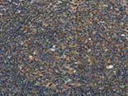 The image on the left is immunohistochemistry of paraffin-embedded Human tonsil tissue using CSB-PA286879(SYN1 Antibody) at dilution 1/40, on the right is treated with synthetic peptide. (Original magnification: ×200)