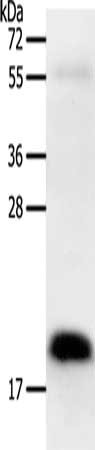 Gel: 12%SDS-PAGE, Lysate: 40 ug, Lane: Human colon cancer tissue, Primary antibody: CSB-PA286956(PTN Antibody) at dilution 1/600, Secondary antibody: Goat anti rabbit IgG at 1/8000 dilution, Exposure time: 20 seconds