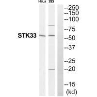 Western blot analysis of extracts from HeLa/293 cells, using STK33 antibody.