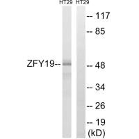 Western blot analysis of extracts from HT-29 cells, using ZFYVE19 antibody.