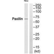 Western blot analysis of extracts from HeLa cells, using Paxillin (Ab-272) antibody.