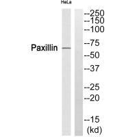 Western blot analysis of extracts from HeLa cells, using Paxillin (Ab-272) antibody.