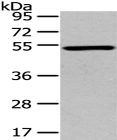 Gel: 8%SDS-PAGE,Lysate: 40 ug,,Primary antibody: CSB-PA288008(TSPYL1 Antibody) at dilution 1/200 dilution,Secondary antibody: Goat anti rabbit IgG at 1/8000 dilution,Exposure time: 2 minutes