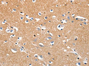 The image on the left is immunohistochemistry of paraffin-embedded Human brain tissue using CSB-PA288262(LRP3 Antibody) at dilution 1/80, on the right is treated with synthetic peptide. (Original magnification: ×200)
