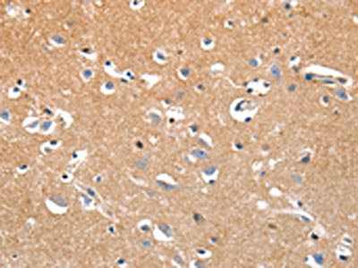 The image on the left is immunohistochemistry of paraffin-embedded Human brain tissue using CSB-PA288262(LRP3 Antibody) at dilution 1/80, on the right is treated with synthetic peptide. (Original magnification: ×200)