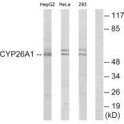 Western blot analysis of extracts from HepG2 cells, HeLa cells and 293 cells, using Cytochrome P450 26A1 antibody.