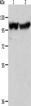 Gel: 10%SDS-PAGE, Lysate: 40 ug, Lane 1-2: Human fetal muscle tissue, hela cells, Primary antibody: CSB-PA288460(ACTN3 Antibody) at dilution 1/400, Secondary antibody: Goat anti rabbit IgG at 1/8000 dilution, Exposure time: 5 seconds