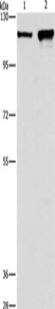 Gel: 10%SDS-PAGE, Lysate: 40 ug, Lane 1-2: K562 cells, hela cells, Primary antibody: CSB-PA288517(CAPRIN1 Antibody) at dilution 1/250, Secondary antibody: Goat anti rabbit IgG at 1/8000 dilution, Exposure time: 20 seconds