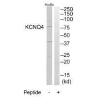 Western blot analysis of extracts from HuvEc cells, using KCNQ4 antibody.