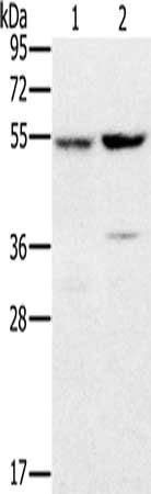 Gel: 8%SDS-PAGE, Lysate: 40 ug, Lane 1-2: Human fetal liver tissue, K562 cells, Primary antibody: CSB-PA288701(PPM1F Antibody) at dilution 1/200, Secondary antibody: Goat anti rabbit IgG at 1/8000 dilution, Exposure time: 10 seconds