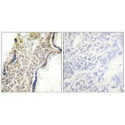 Immunohistochemical analysis of paraffin-embedded human placenta tissue using p14 ARF antibody.