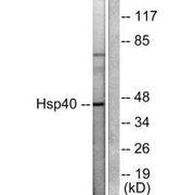 Western blot analysis of extracts from COLO205 cells, using HSP40 antibody.