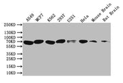 Western Blot Positive WB detected in: A549 whole cell lysate, MCF7 whole cell lysate, K562 whole cell lysate, 293T whole cell lysate, U251 whole cell lysate, Hela whole cell lysate, Mouse Brain tissue lysate, Rat Brain tissue lysate All lanes: BTR...