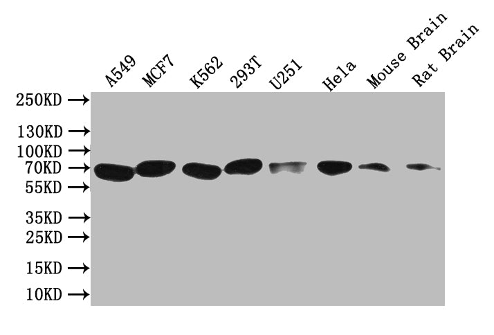 Western Blot Positive WB detected in: A549 whole cell lysate, MCF7 whole cell lysate, K562 whole cell lysate, 293T whole cell lysate, U251 whole cell lysate, Hela whole cell lysate, Mouse Brain tissue lysate, Rat Brain tissue lysate All lanes: BTR...
