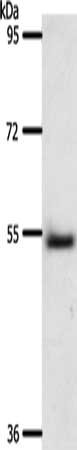 Gel: 8%SDS-PAGE, Lysate: 40 ug, Lane: Human liver cancer tissue, Primary antibody: CSB-PA289003(A1BG Antibody) at dilution 1/500, Secondary antibody: Goat anti rabbit IgG at 1/8000 dilution, Exposure time: 2 minutes