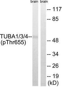 Western blot analysis of extracts from Rat brain cells using TUBA1/3/4 (Phospho-Tyr272) Antibody.The lane on the right is treated with the antigen-specific peptide.