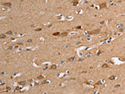 The image on the left is immunohistochemistry of paraffin-embedded Human brain tissue using CSB-PA289221(TLR8 Antibody) at dilution 1/30, on the right is treated with fusion protein. (Original magnification: ×200)