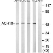 Western blot analysis of extracts from A549 cells, COLO cells, HeLa cells and 293 cells, using CHRNA10 antibody.