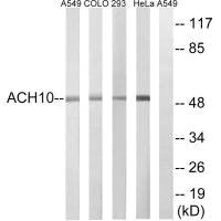 Western blot analysis of extracts from A549 cells, COLO cells, HeLa cells and 293 cells, using CHRNA10 antibody.