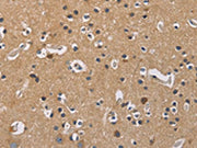 The image on the left is immunohistochemistry of paraffin-embedded Human brain tissue using CSB-PA290015(GNB5 Antibody) at dilution 1/20, on the right is treated with fusion protein. (Original magnification: ×200)