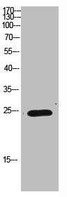 Western Blot analysis of HEPG2 cells using Antibody diluted at 1000. Secondary antibody was diluted at 1:20000