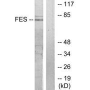 Western blot analysis of extracts from HUVEC cells, treated with serum (20%, 30mins), using FES antibody.
