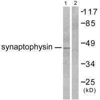Western blot analysis of extracts from LOVO cells, using Synaptophysin antibody.