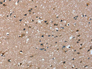 The image on the left is immunohistochemistry of paraffin-embedded Human brain tissue using CSB-PA290336(TRIM31 Antibody) at dilution 1/20, on the right is treated with fusion protein. (Original magnification: ×200)