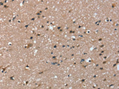 The image on the left is immunohistochemistry of paraffin-embedded Human brain tissue using CSB-PA290336(TRIM31 Antibody) at dilution 1/20, on the right is treated with fusion protein. (Original magnification: ×200)