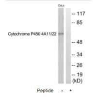 Western blot analysis of extracts from COLO205, HuvEc and HeLa cells, using CYTOCHROME P450 4A11/22 antibody.