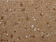 The image on the left is immunohistochemistry of paraffin-embedded Human brain tissue using CSB-PA290837(PPP1R13L Antibody) at dilution 1/30, on the right is treated with synthetic peptide. (Original magnification: ×200)