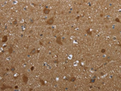 The image on the left is immunohistochemistry of paraffin-embedded Human brain tissue using CSB-PA290837(PPP1R13L Antibody) at dilution 1/30, on the right is treated with synthetic peptide. (Original magnification: ×200)